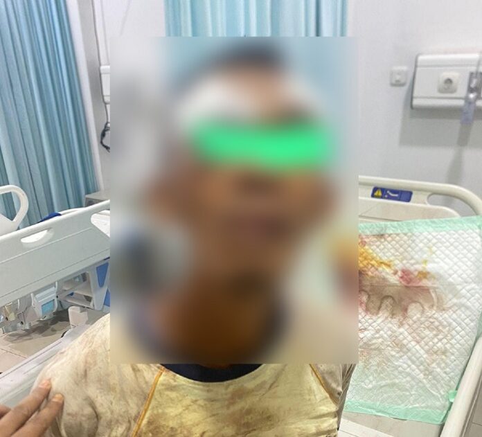RH, pelaku pencurian diberi perawatan di rumah sakit Bhayangkara Polda Kalbar Anton Soedjarwo, usai digebuk massa.